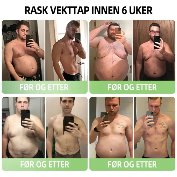 Piguiay® GLP-1 Moringa Afslankende & Helsefremmende Dråper (Matgradsfettbrenner – Utviklet av eksperter innen sekretologi og metabolisme) 🎁