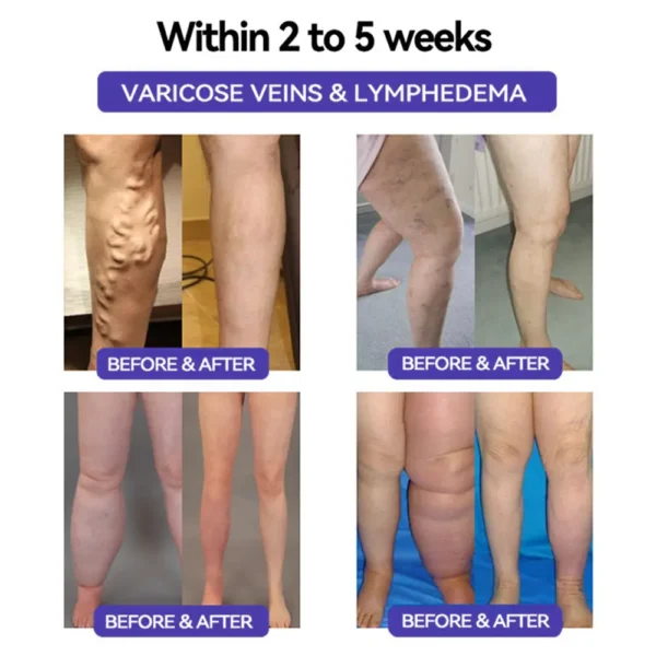 See ResuIts in 7 Days 💫 Piguiay® GABA+gIp-1 SIimming Oral Strips👨‍⚕️DeveIoped by British Obesity Society