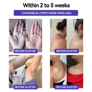 See ResuIts in 7 Days 💫 Piguiay® GABA+gIp-1 SIimming Oral Strips👨‍⚕️DeveIoped by British Obesity Society