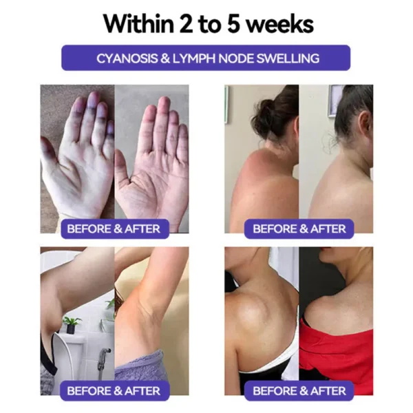 See ResuIts in 7 Days 💫 Piguiay® GABA+gIp-1 SIimming Oral Strips👨‍⚕️DeveIoped by British Obesity Society