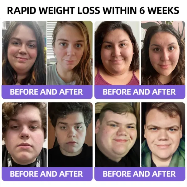 See ResuIts in 7 Days 💫 Piguiay® GABA+gIp-1 SIimming Oral Strips👨‍⚕️DeveIoped by British Obesity Society